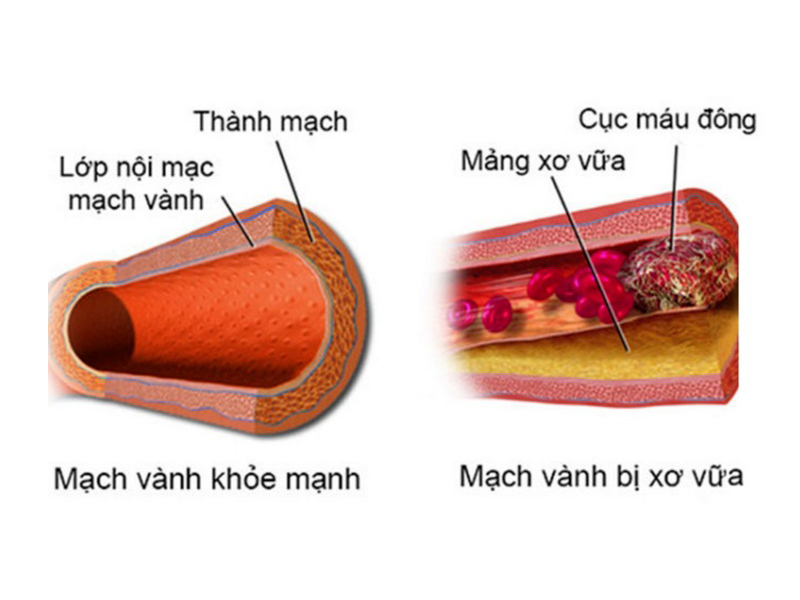 mot-gia-dinh-co-28-nguoi-mac-benh-di-truyen-co-the-chet-truoc-tuoi-20