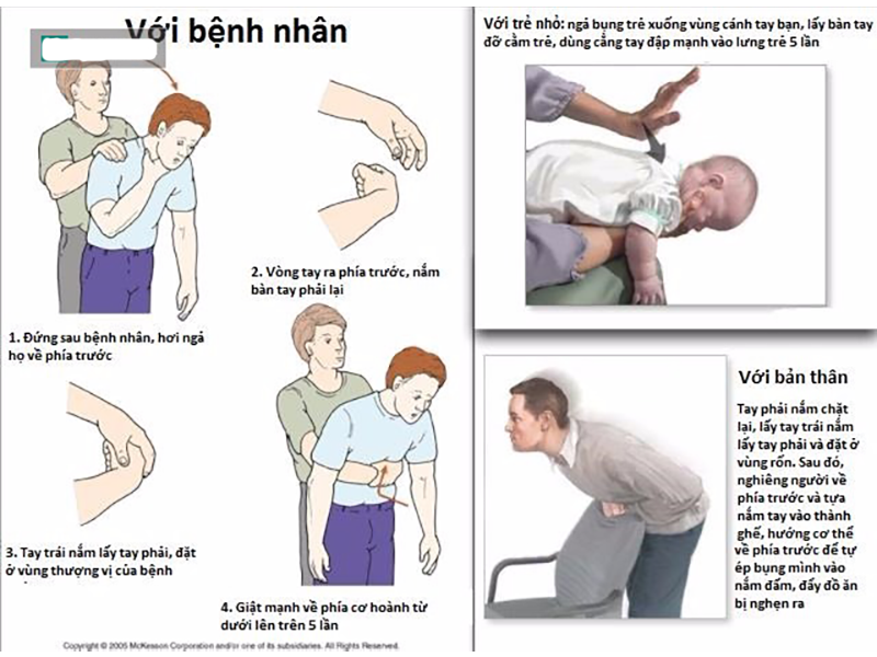 nguoi-dan-ong-suyt-mat-mang-vi-chiec-quay-cach-so-cuu-cho-nguoi-bi-nghen