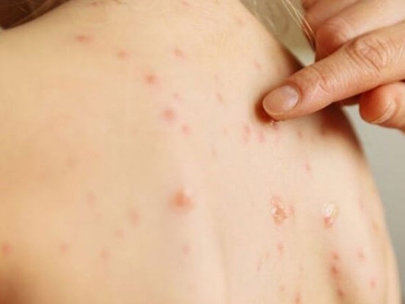 ban-soi-co-ngua-khong-nhung-dieu-ban-can-hieu-ro